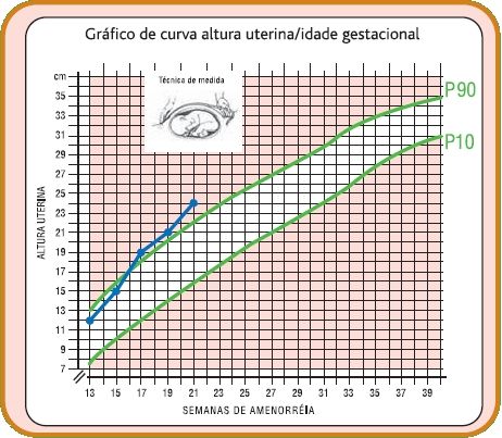 curva uterina