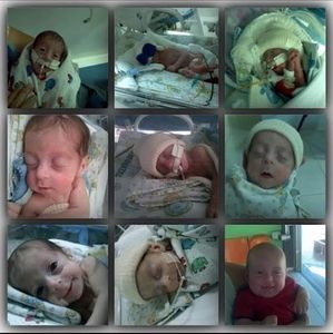 Bebes prematurosResultado