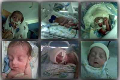 1674 entrevista estimulacao precoce do bebe prematuro