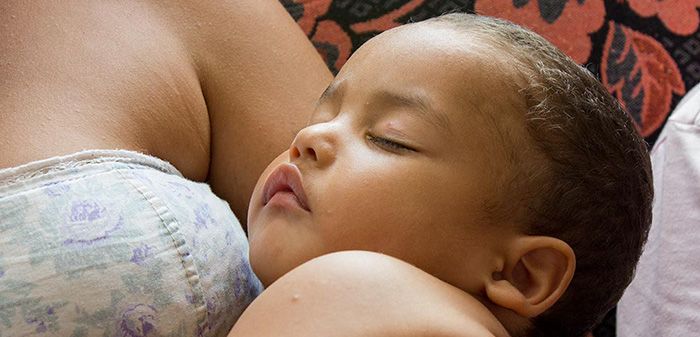 doencas de pele comuns em bebe