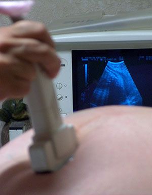 porque-as-gestante-nao-fazem-o-pre-natal