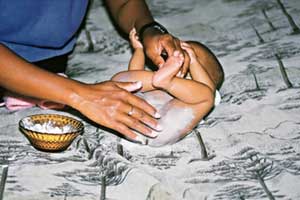 bebe dois meses assaduras