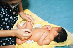 higiene bebe cordao umbilical
