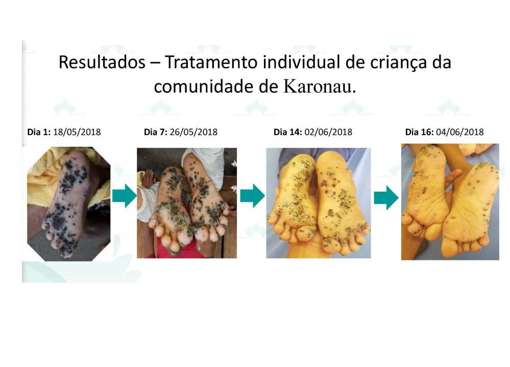 tungase evoluo